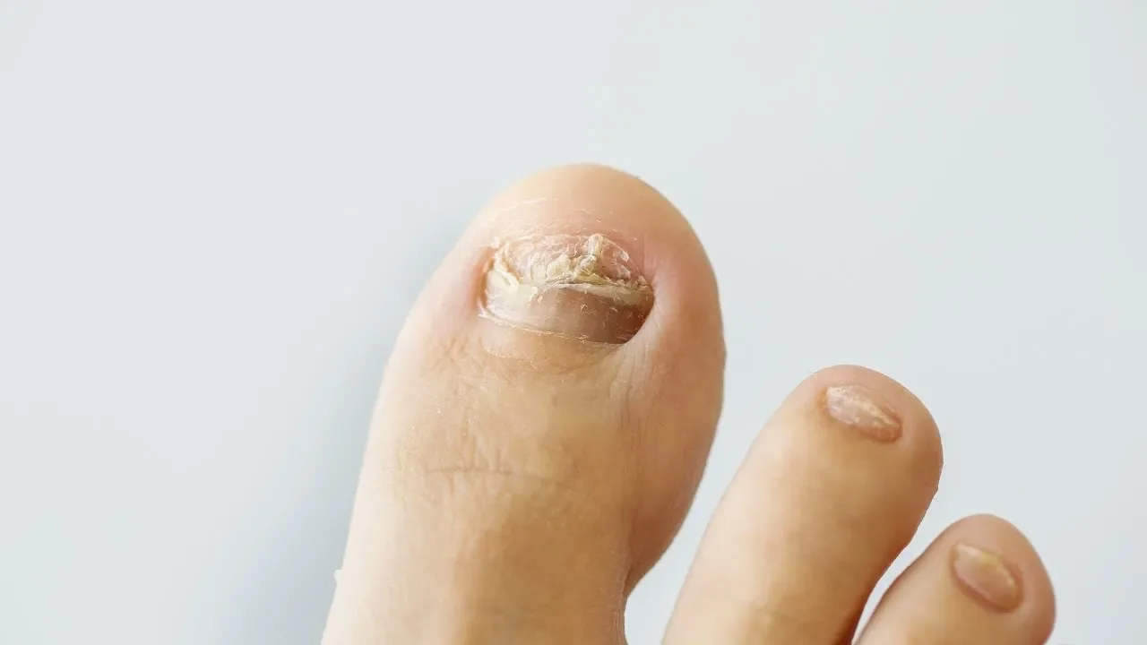 Exofeet oil